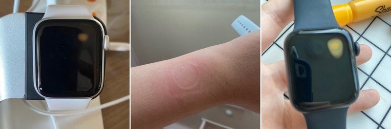 Apple Watch SE overheat issue