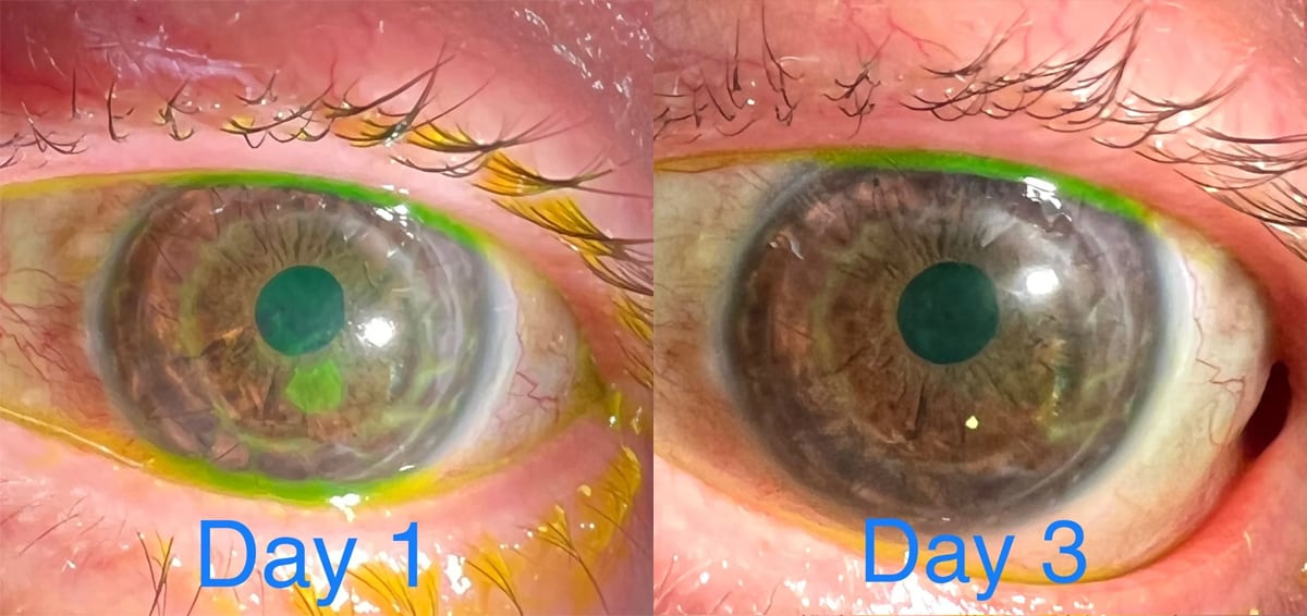 Doctor iPhone 13 Pro Max check eyes